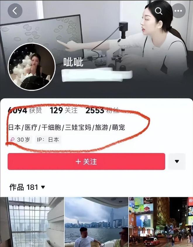 曝光脸色发黑引发担忧金龟子美容很享受j9九游会登录61岁王宁日本换血手术(图12)